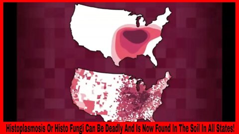 Histoplasmosis Or Histo Fungi Can Be Deadly And Is Now Found In The Soil In All States!