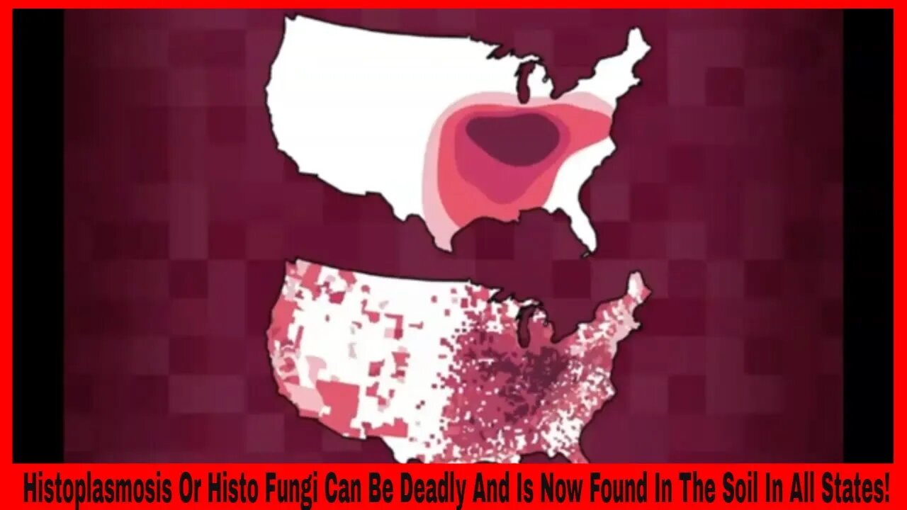 Histoplasmosis Or Histo Fungi Can Be Deadly And Is Now Found In The Soil In All States!