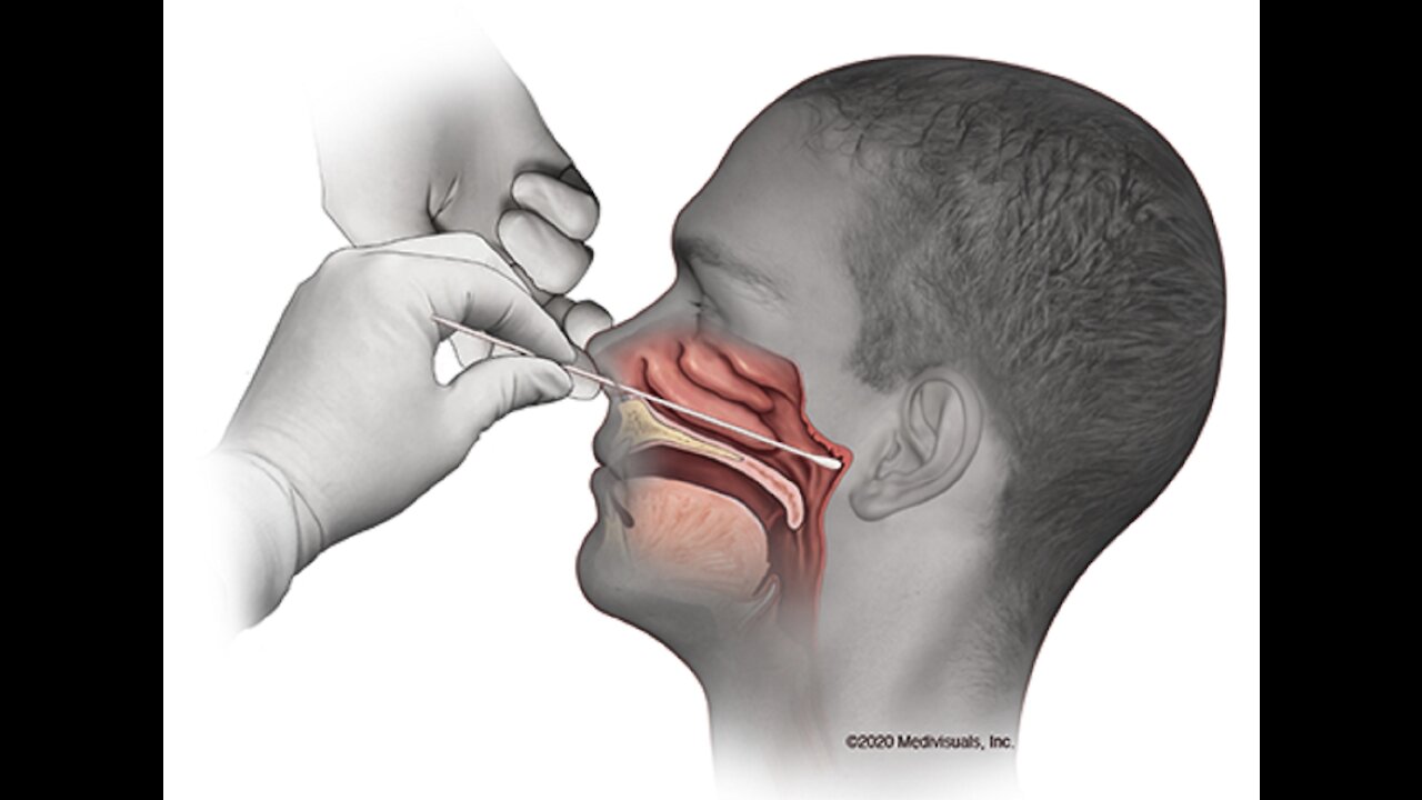 Prueba COVID-19 por la nariz tiene ÓXIDO DE ETILENO que causa cáncer al cerebro, linfático, leucemia