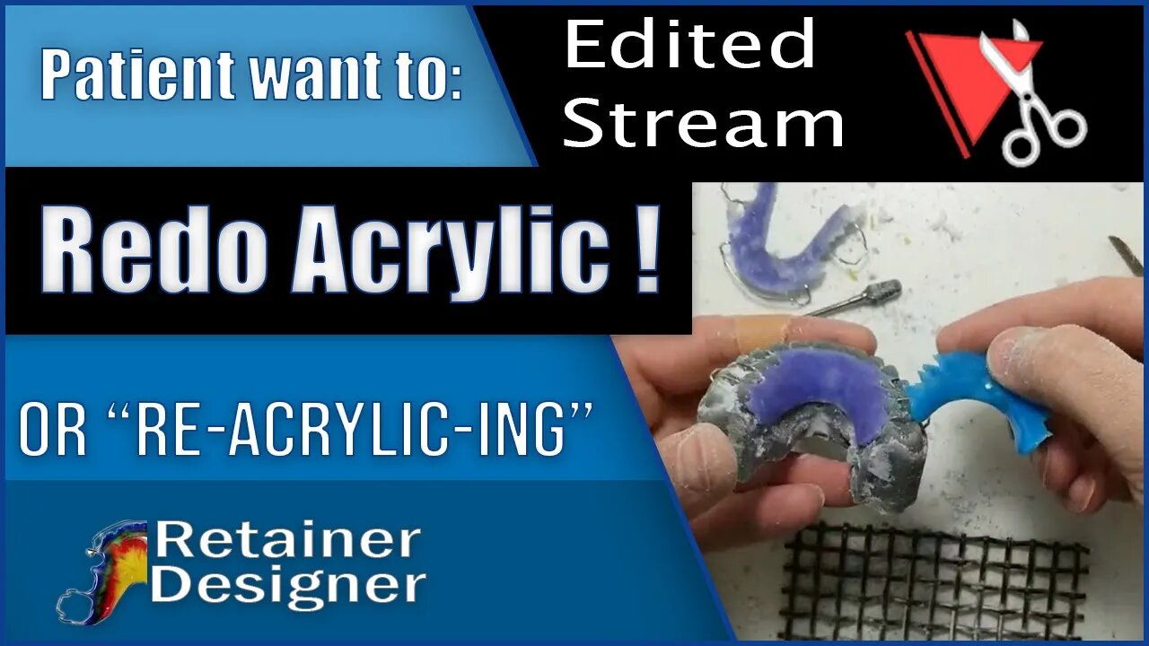 Live Stream Edited: "Re-Acrylic-ing" Patient wants to change the color!