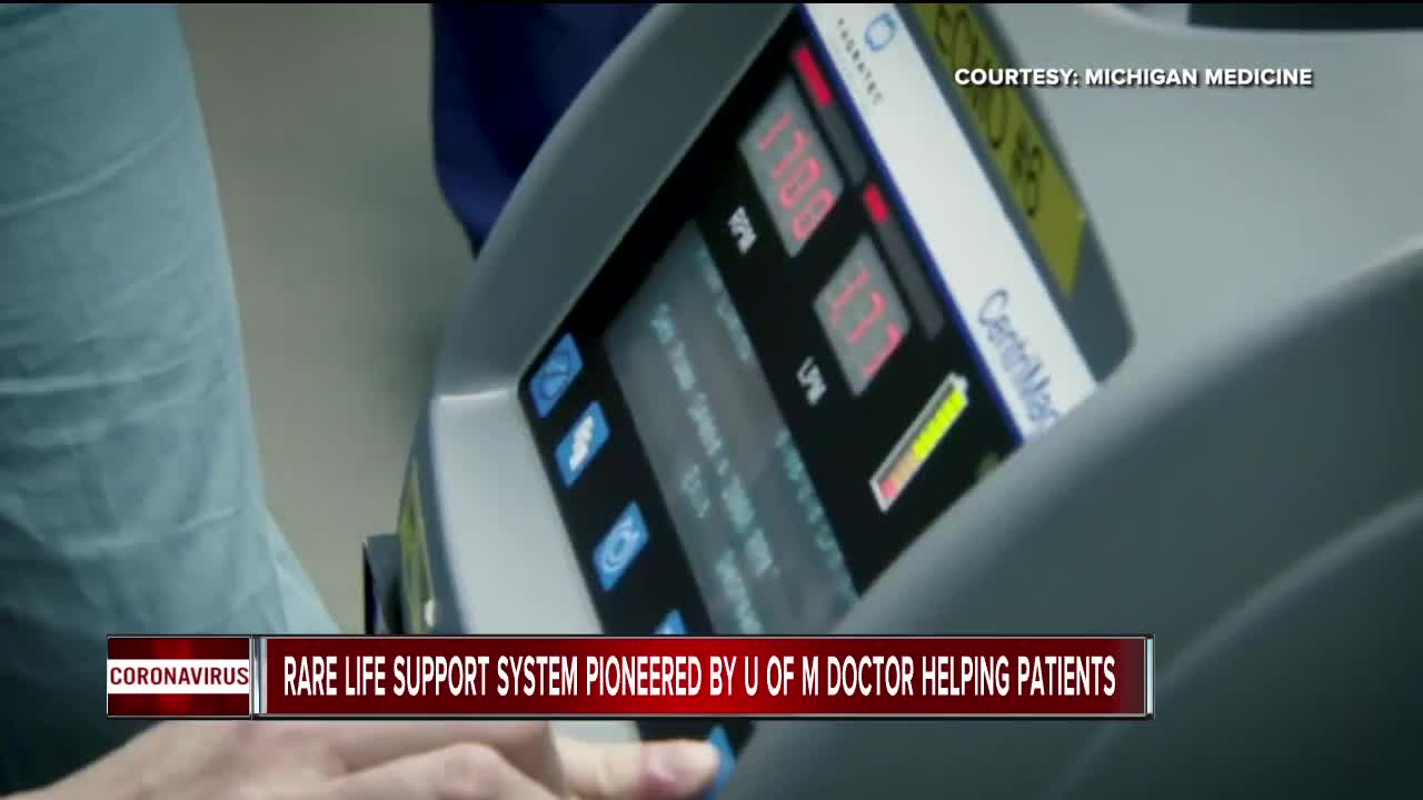 Rare life support system pioneered by U of M doctor helping patients