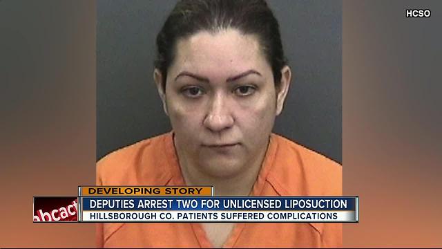 Fake liposuction doctors arrested in Tampa