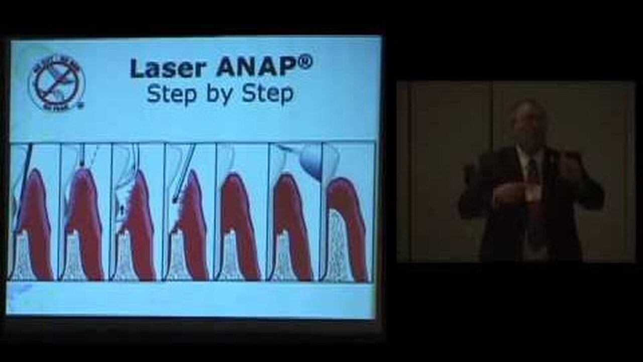Phil Sukel, DDS & Dave Regiani, DDS: The Use of Lasers to Improve Gum Conditions IAOMT Chicago 2008