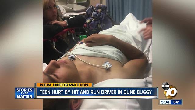 Teen hurt by hit and run driver in dune buggy