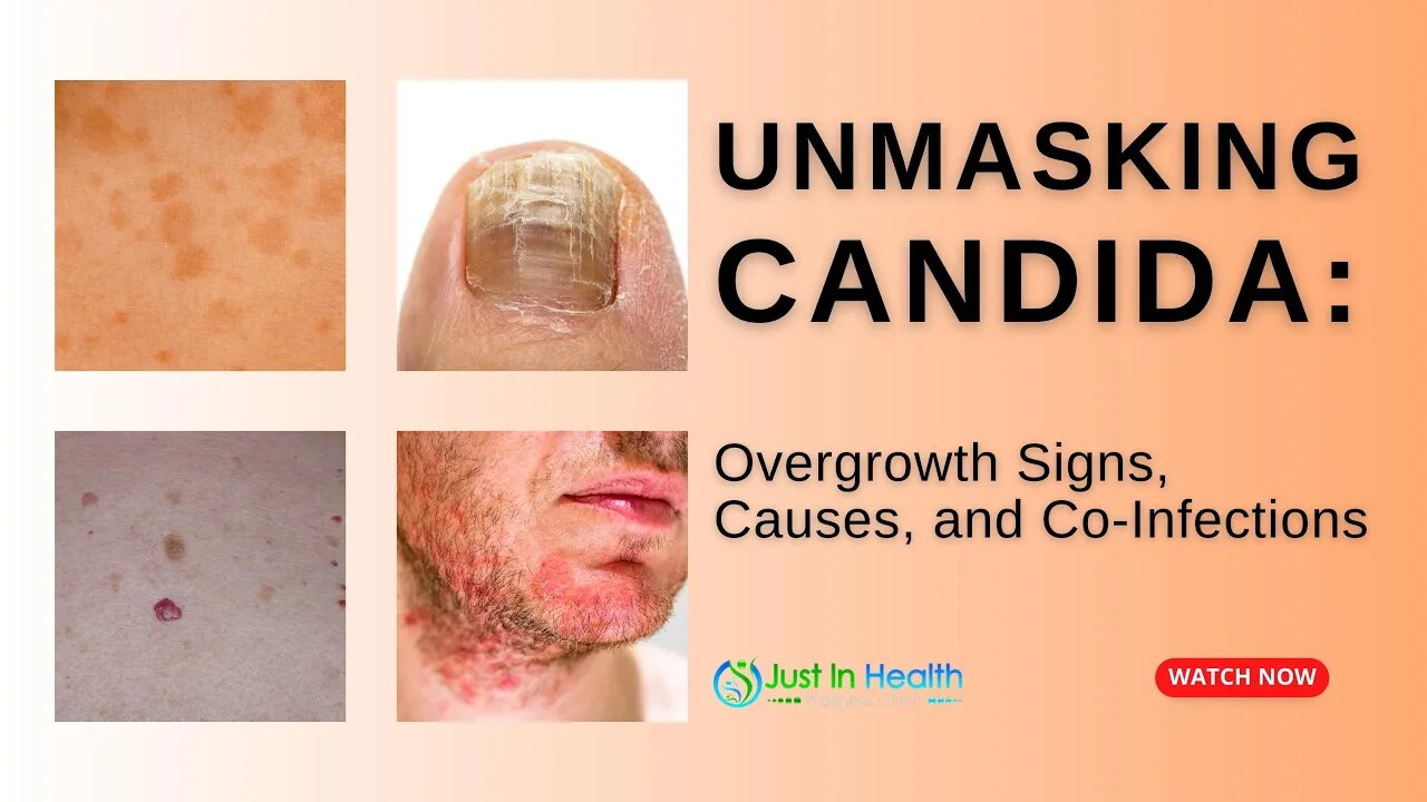 Unmasking Candida: Overgrowth Signs, Causes, and Co-Infections