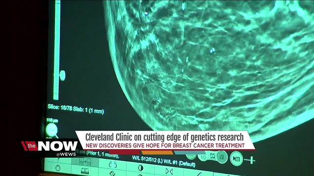 Genetic advancements at Cleveland Clinic give hope for breast cancer treatment