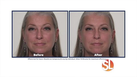 Watch Plexaderm reduce sagging skin and puffy eye bags