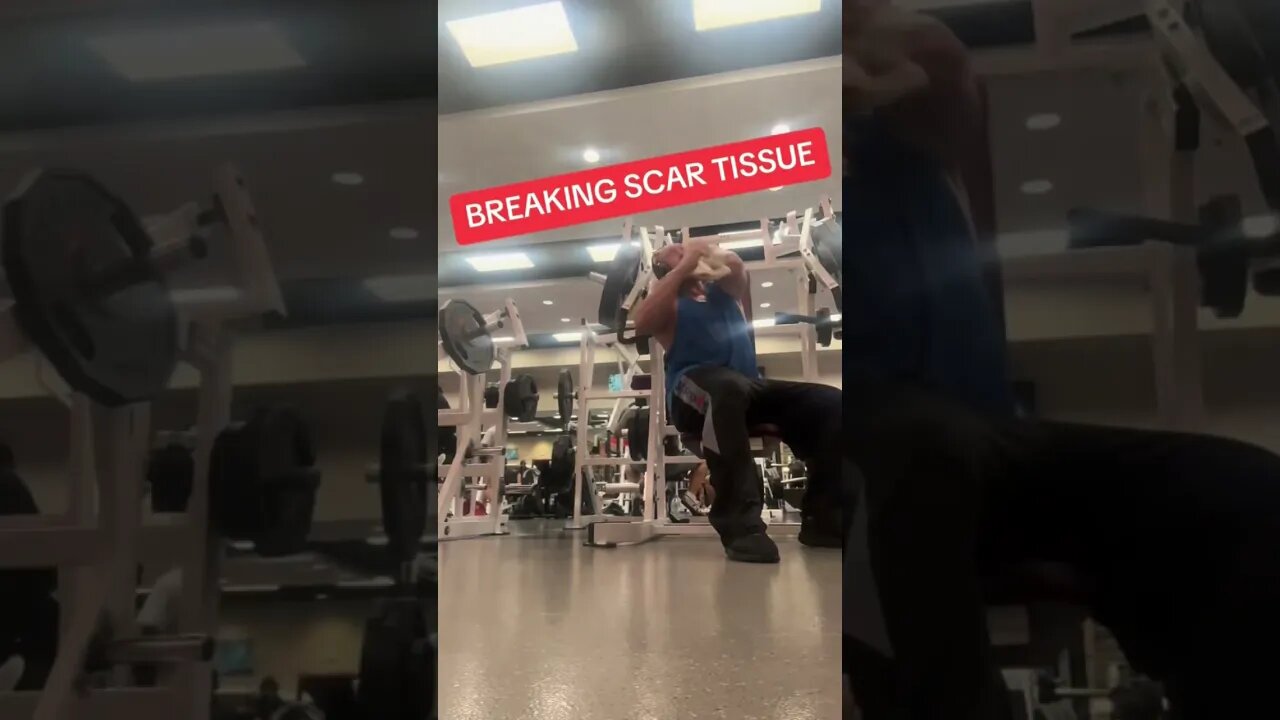 Ryback Breaking Scar Tissue Under Scapula On Hammer Strength Machine Handle