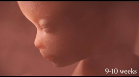 Abortion Documentary (Trailer)