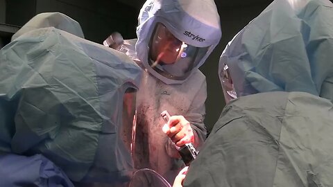 Total Knee Replacement Surgery - Scott A. Barbour, M.D.