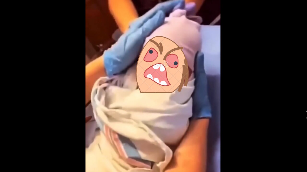 Oops!!! It was just a blow to the head, it was nothing! Will be