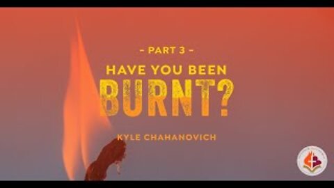 Have you been Burnt? pt. 3 - Kyle Chahanovich