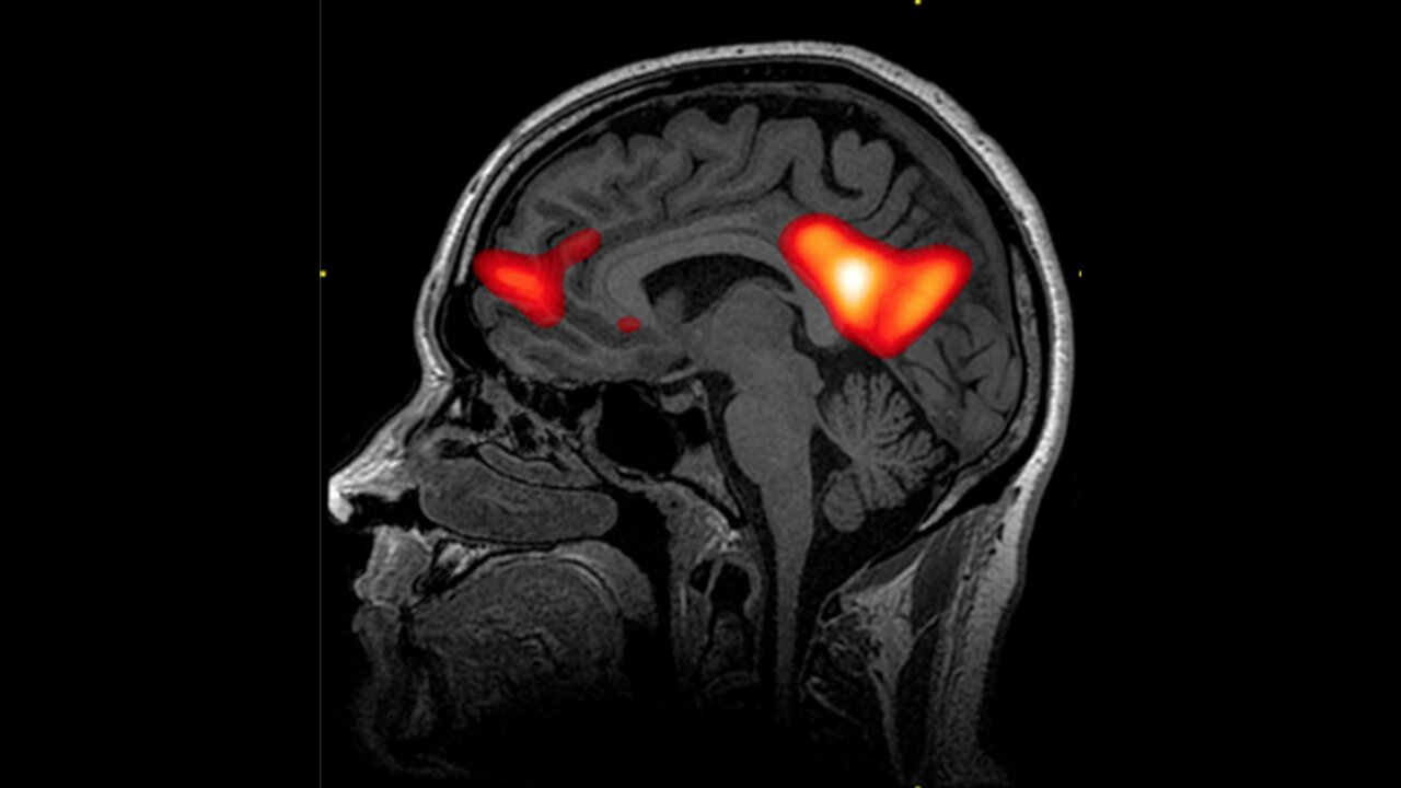 This Is Your Brain In Love