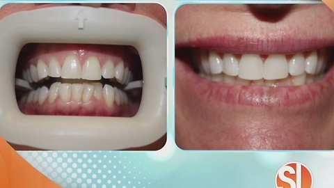 Scottsdale Smiles Dentistry wants to give you a Hollywood smile