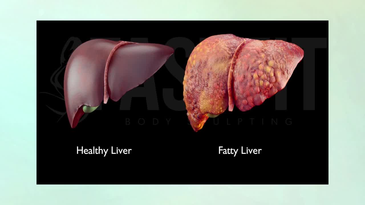 Weight and Your Liver