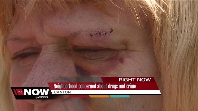 Canton residents say their neighbors are retaliating after reporting illegal activity to police