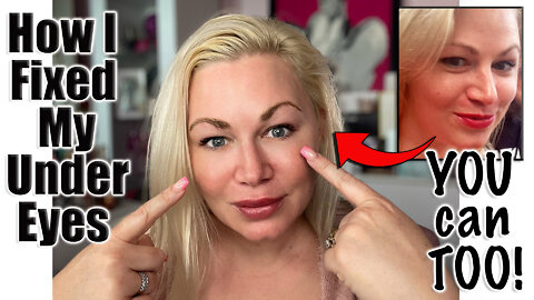 How I fixed my Under Eyes with DIY | Code Jessica10 saves you Money at All Approved Vendors