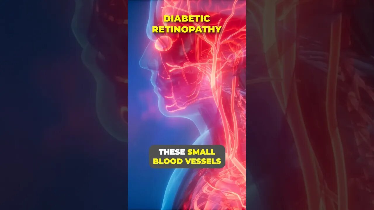 How Diabetes Affects Your Eyes! #shortsfeed #shorts