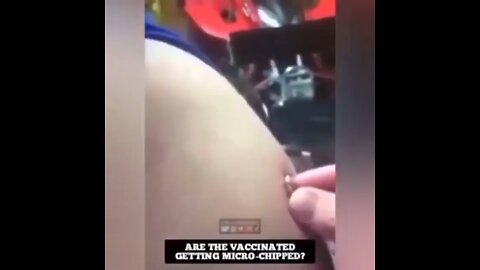 Magnet sticking to arm after vaccine