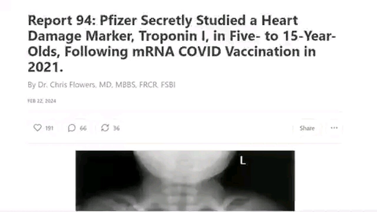 Intent to commit genocide.