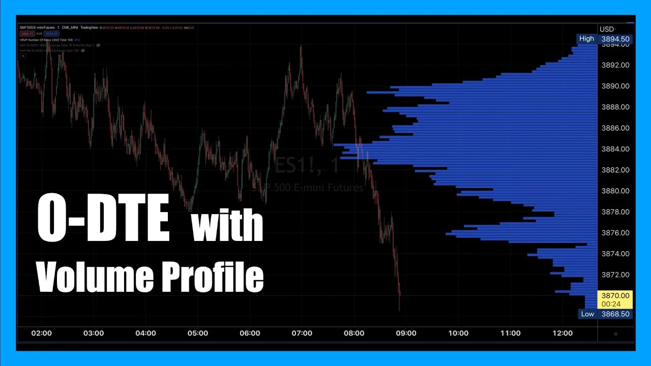 0DTE Volume Profile Analysis for September 26