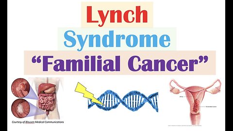 Lynch Syndrome (Hereditary Non-Polyposis Colorectal Cancer) Genetics, Symptoms, Diagnosis, Treatment
