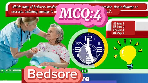 Bedsore mcq