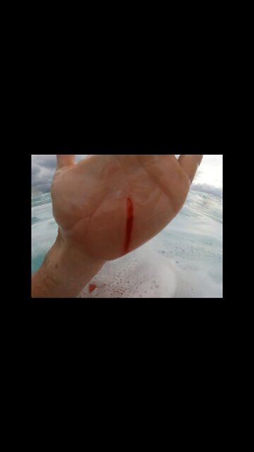 Tube coral cut my hand while surfing! Then smashed by wave!