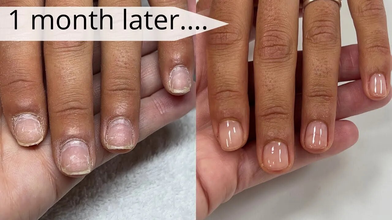 UPDATE!! Growing out bitten and damaged nails [Manicure #4] Watch Me Work