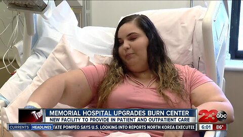 Memorial Hospital opens new burn facility