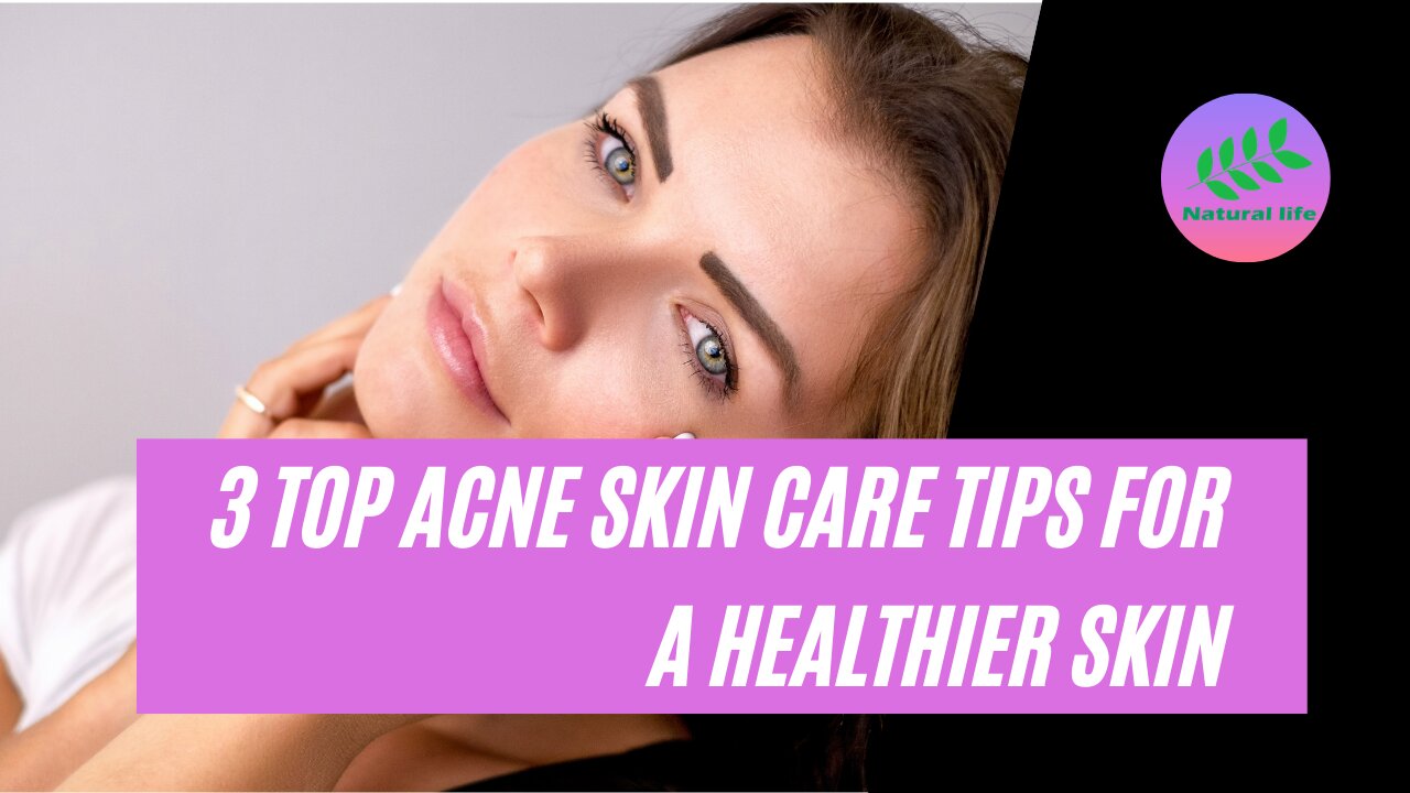 3 Top Acne Skin Care Tips For A Healthier Skin