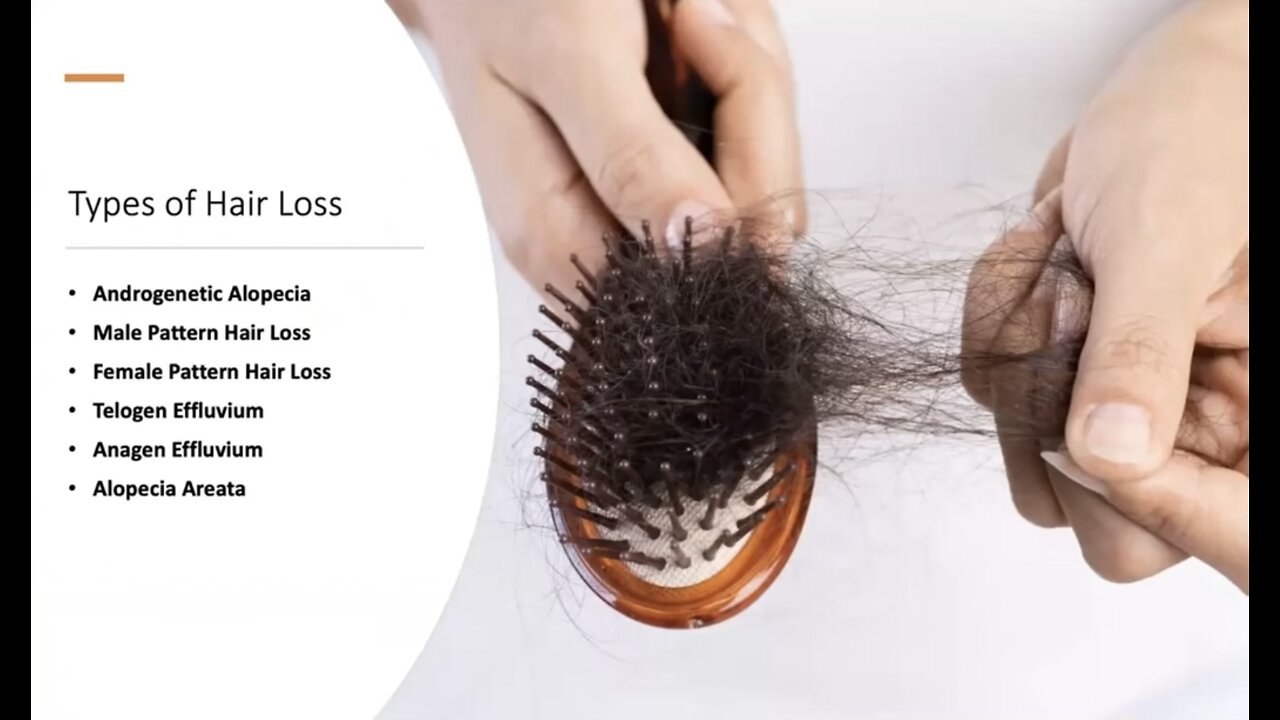 Prevent Hair Loss | Dr. Dori Naerbo | Root USA Global