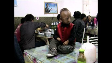 World's Smallest Man Dies