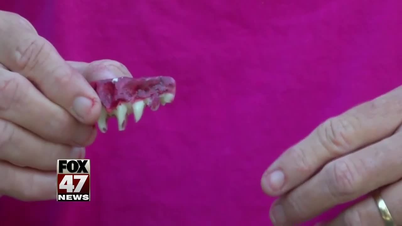 Woman says fake teeth got stuck in her mouth