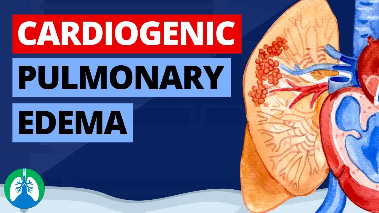 Cardiogenic Pulmonary Edema (Medical Definition) | Quick Explainer Video