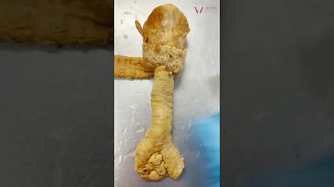 REAL Human Trachea | Why Your Airway Doesn’t Collapse