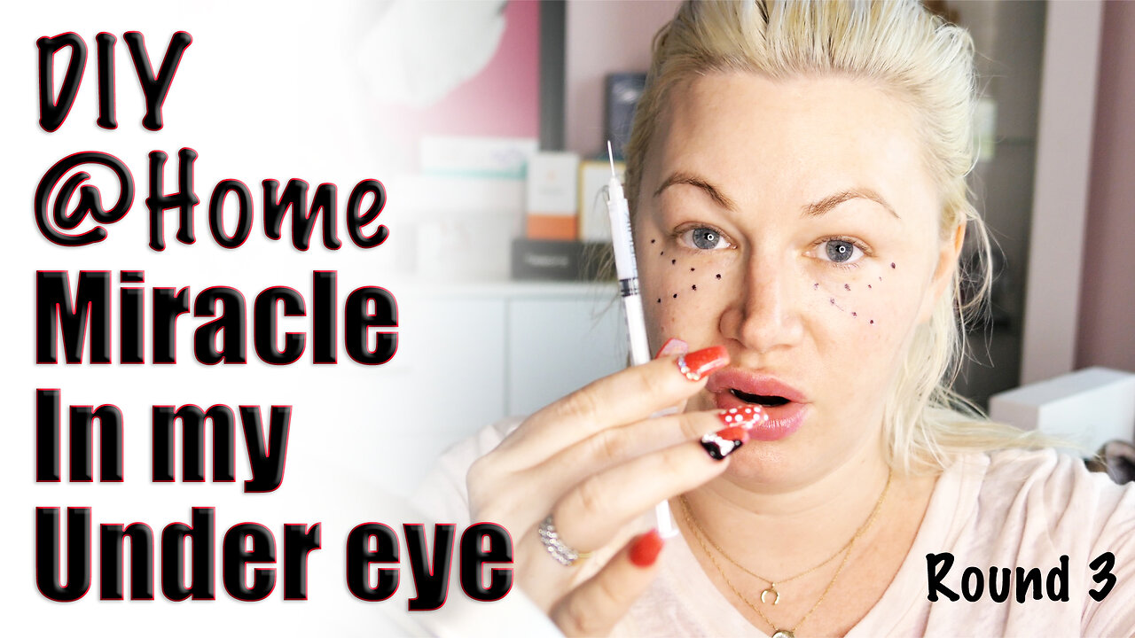 Old Video: Fixing my Under Eyes with Miracle H Round 3, AceCosm| Code Jessica10 Saves you Money