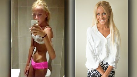 Teen Overcomes Anorexia After Near Death Experience