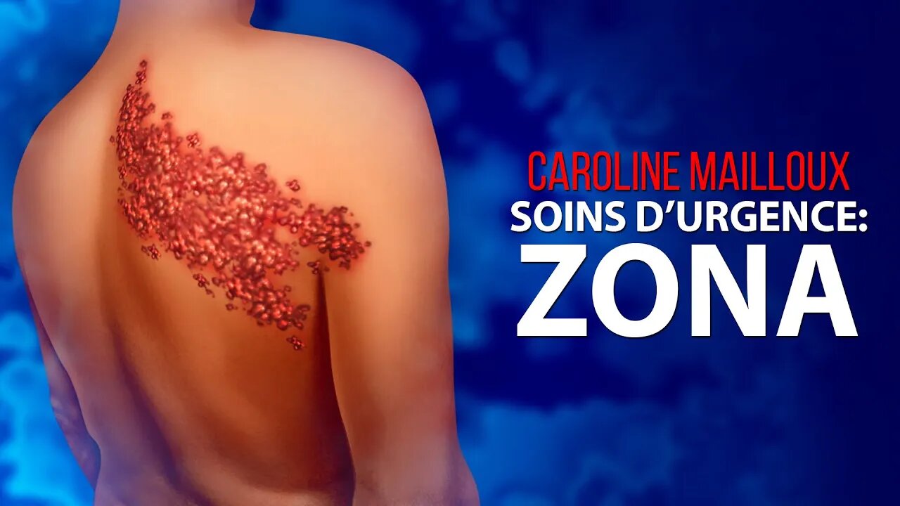 CAROLINE MAILLOUX - SOINS D'URGENCE: ZONA