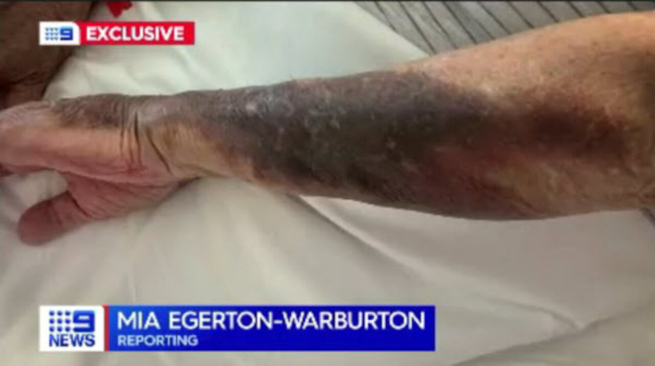 When MSM Australian 9 News channel reporting on "vaccine" side effects