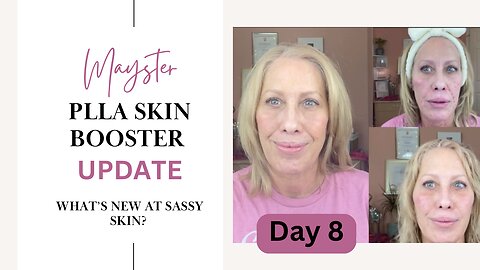 Mayster Skin Booster Update - Day 8 & What’s New for Sassy Skin