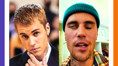 Justin Bieber Unable To Recover Cancels World Tour