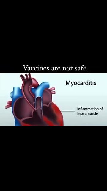 Vaccines are not safe… especially the mRNA Covid death jab.