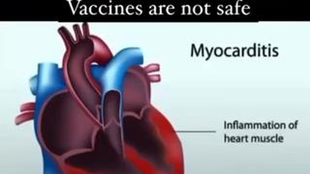 Vaccines are not safe… especially the mRNA Covid death jab.