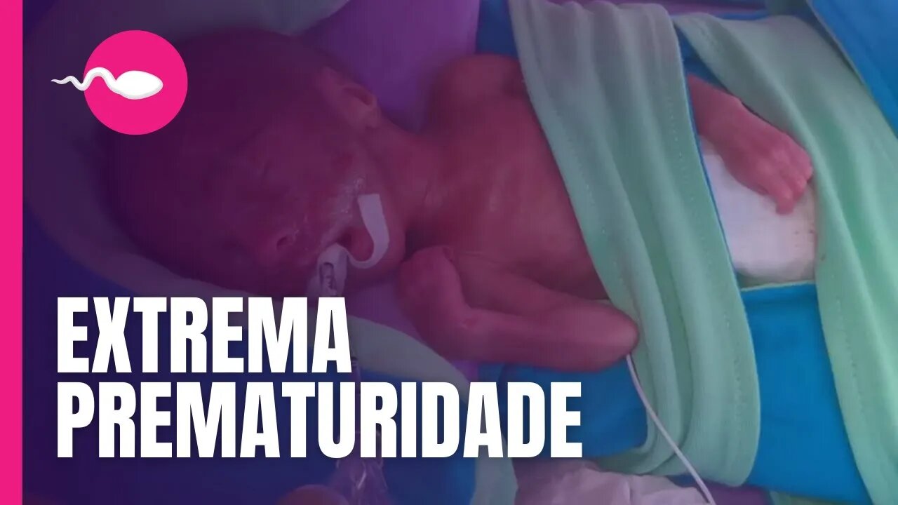 PREMATURIDADE EXTREMA | Filho de Whindersson, quais as CHANCES de um bebê de 22 semanas sobreviver?