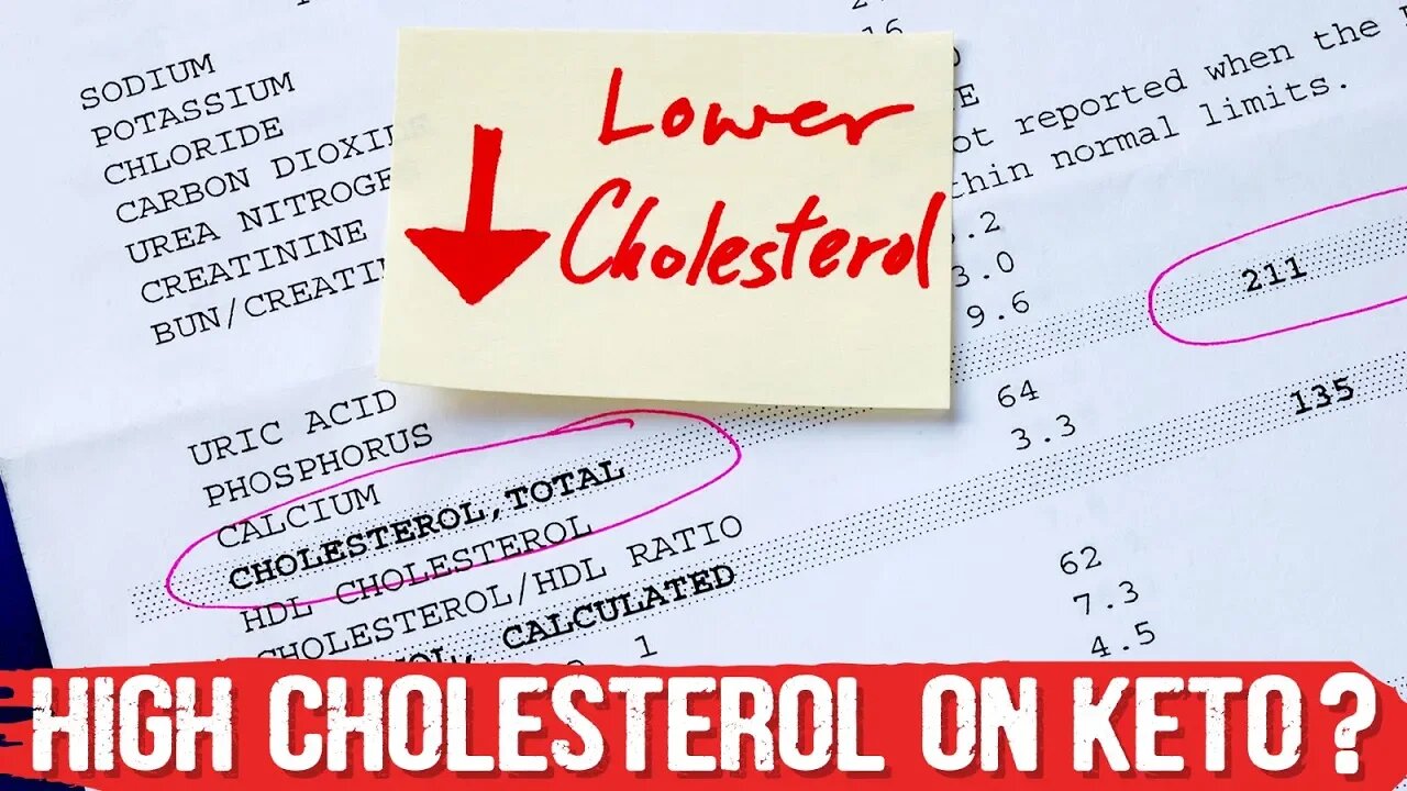 Stop Worrying About LDL & High Cholesterol on Keto Diet – Dr. Berg