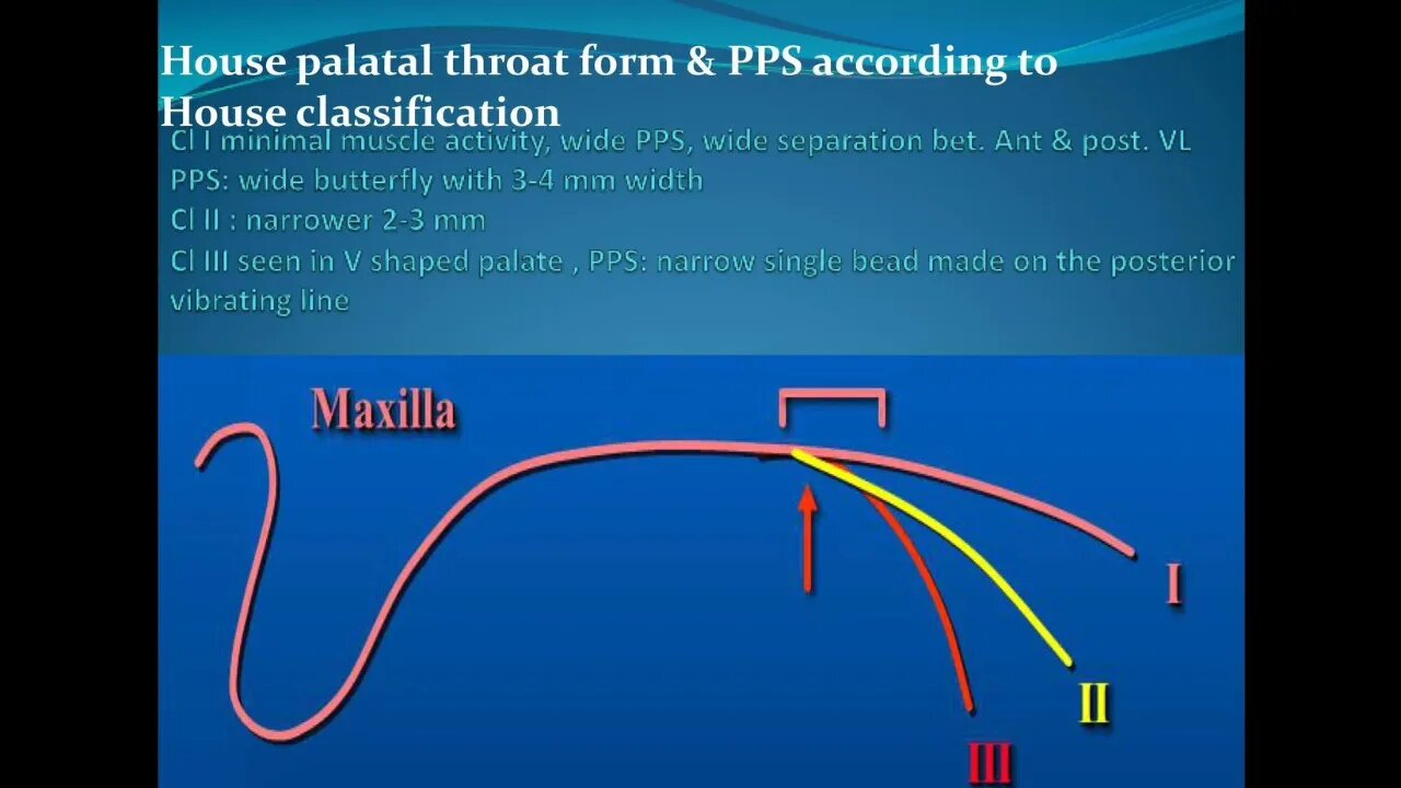 Prosthodontics L5 (Posterior Palatal Seal Area)