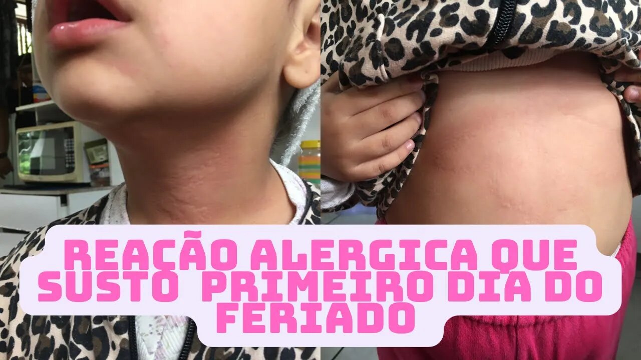 Reação alérgica que susto levei - Primeiro dia do Feriado- vlog