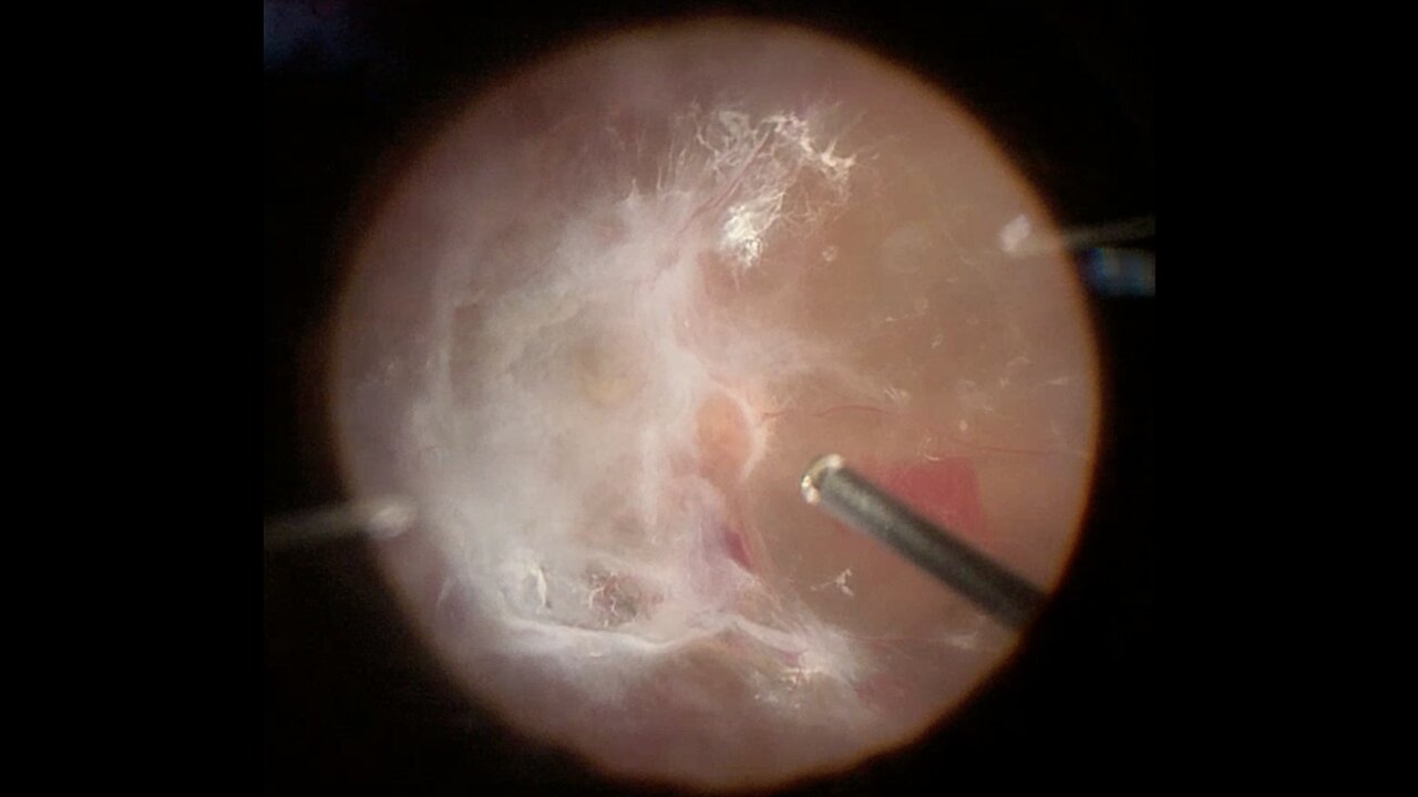 not space ---inside eye