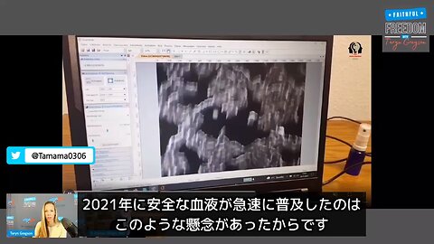 【コロワク】接種者と未接種者の血液比較